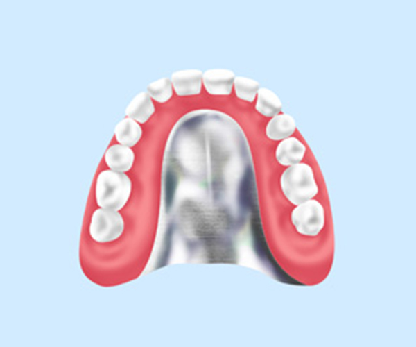 自費入れ歯
